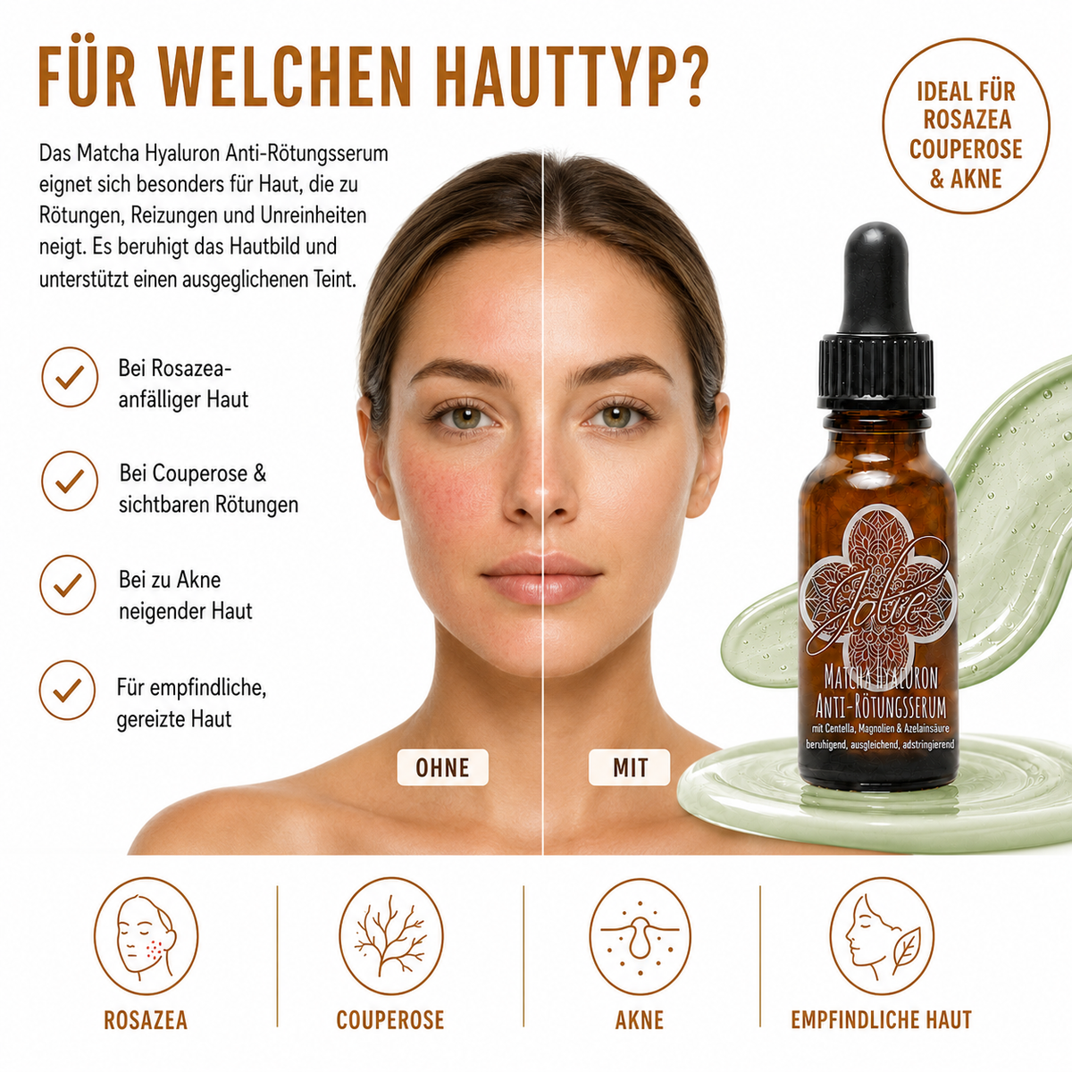 Matcha Hyaluron Anti-Rötungsserum für Rosazea, Couperose & Akne