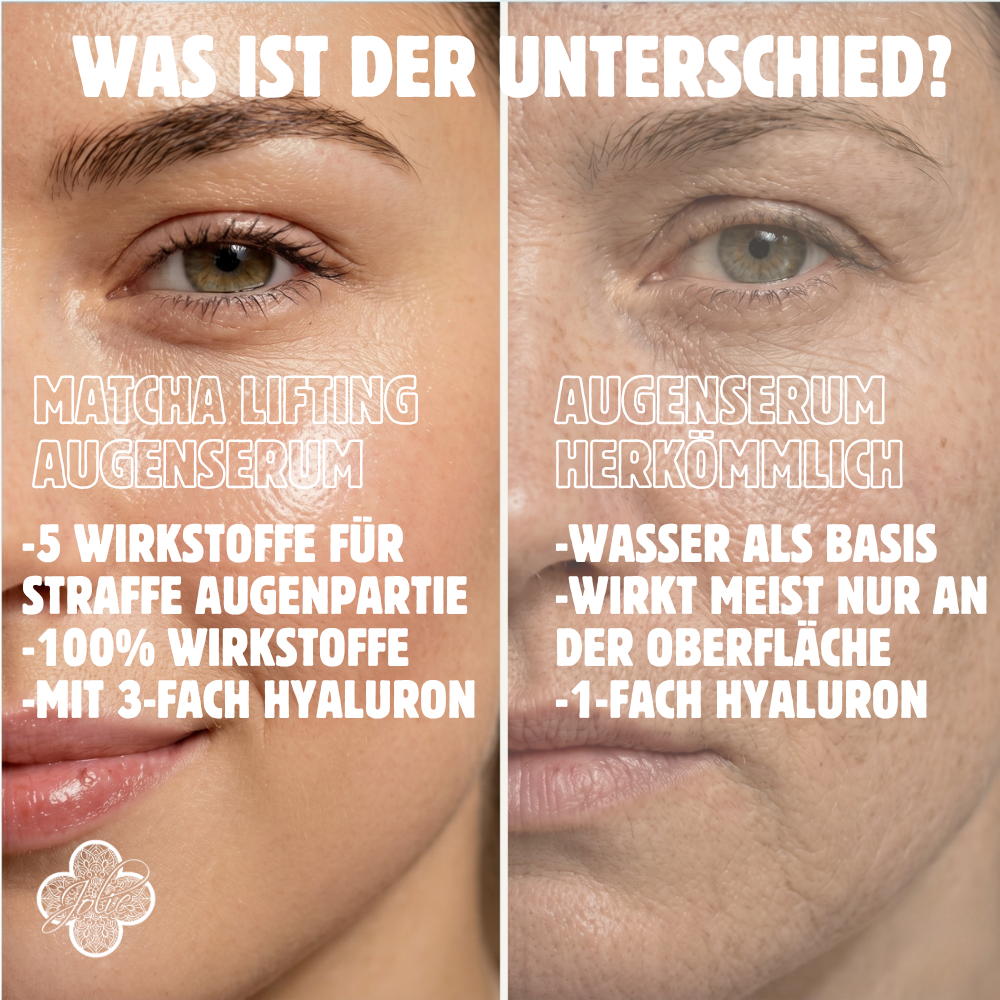Augenserum Matcha Augenlifting Elixier – Peptide, Exosomen & Kollagen Boost