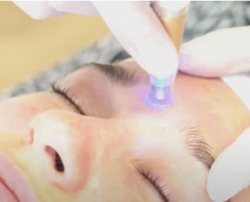 Microneedling Online Schulungsvideo mit Zertifikat