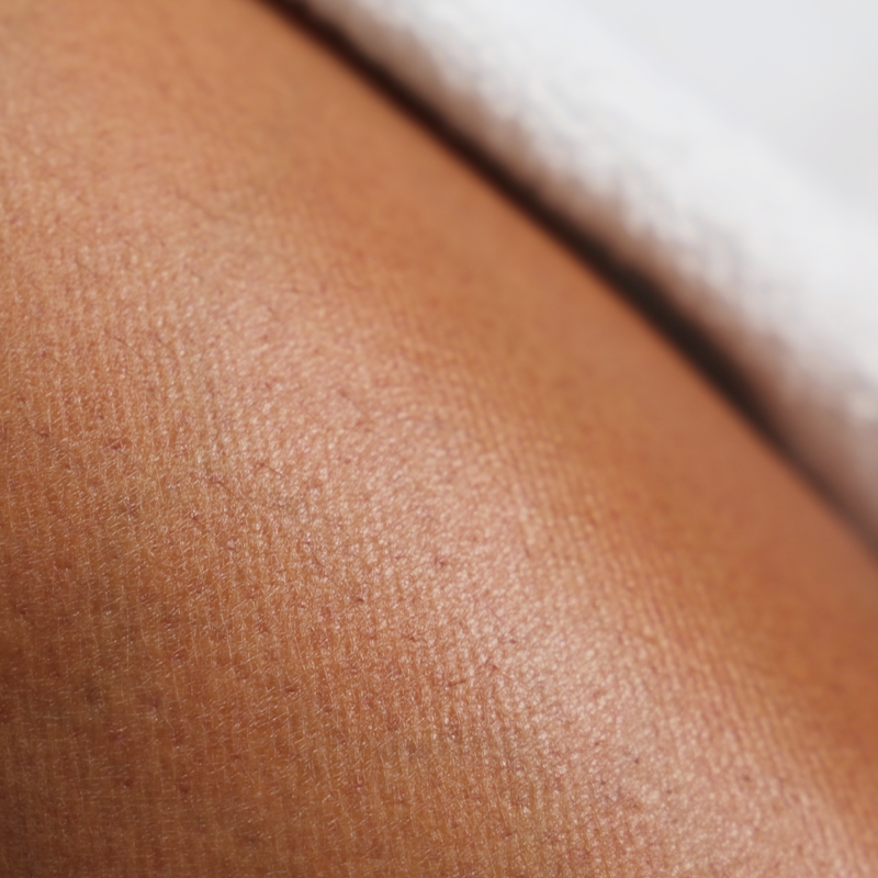 Straffendes Körperserum mit Kaffee, Hyaluron & Alge gegen Cellulite 5 ml ✨