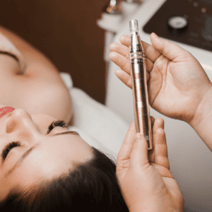 Microneedling Schulung theoretisch und praktisch vor Ort 1 Tag